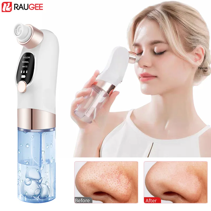 Extracteur de points noirs éle - Air Bubble Remover avis et prix